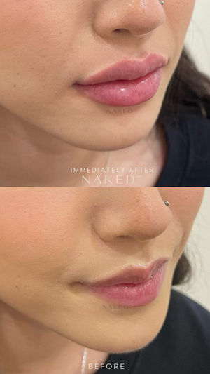 Naked Lips | Lip Filler - NV