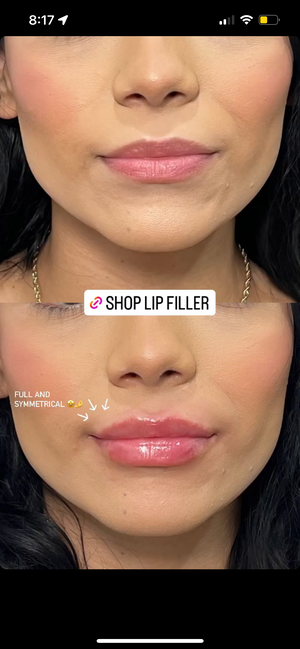 Naked Lips | Lip Filler - NV