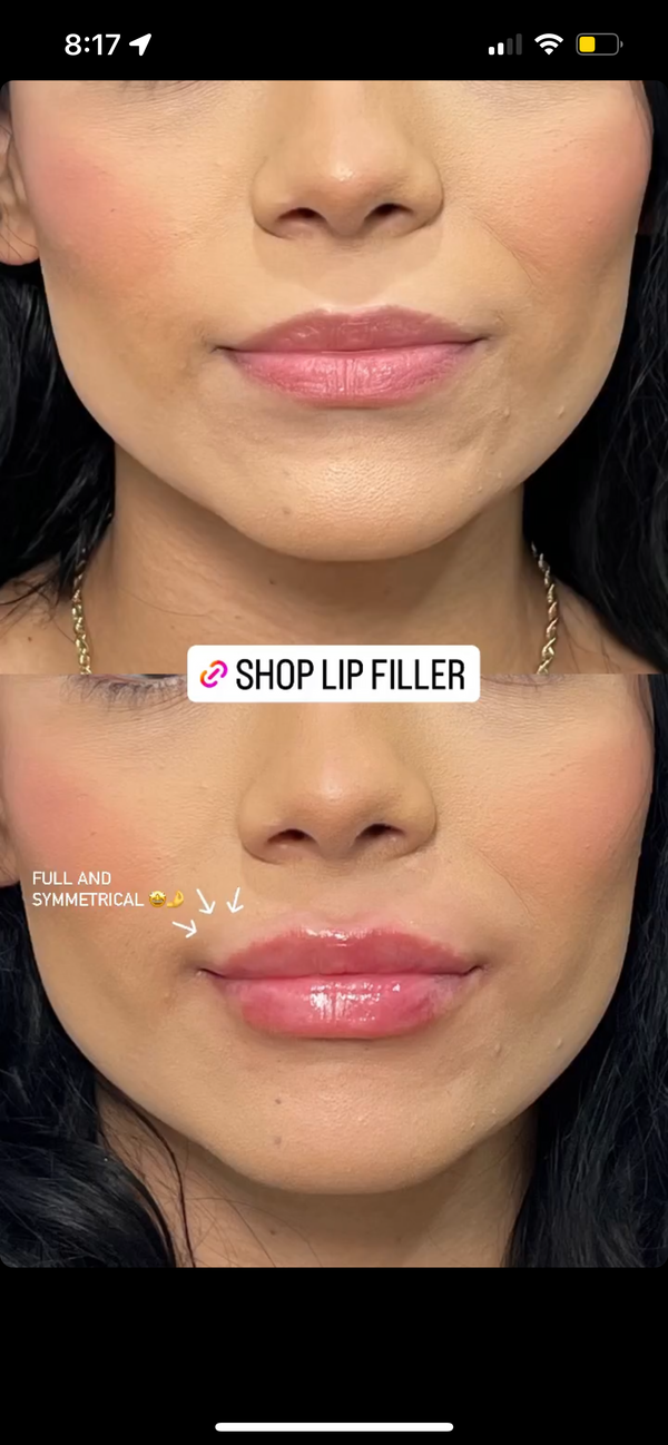 Naked Lips | Lip Filler - NV